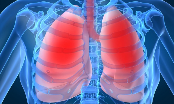 PULMONARY DISEASES