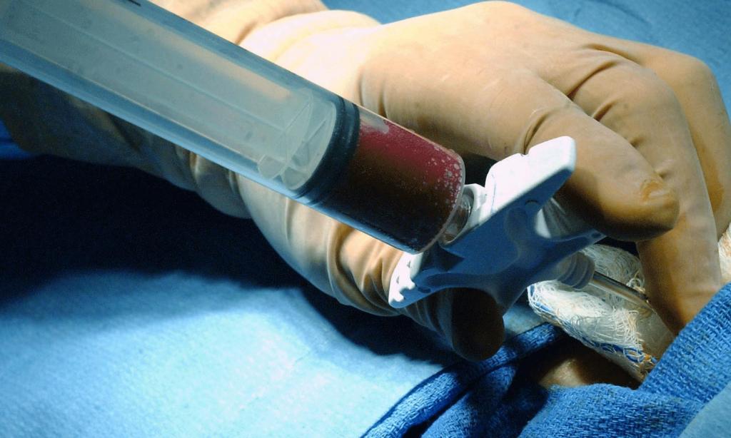 BONE MARROW TRANSPLANTATION