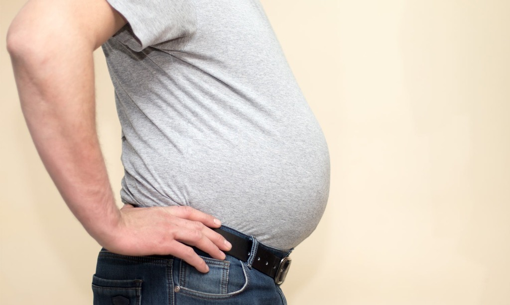 Бариатрическая хирургия