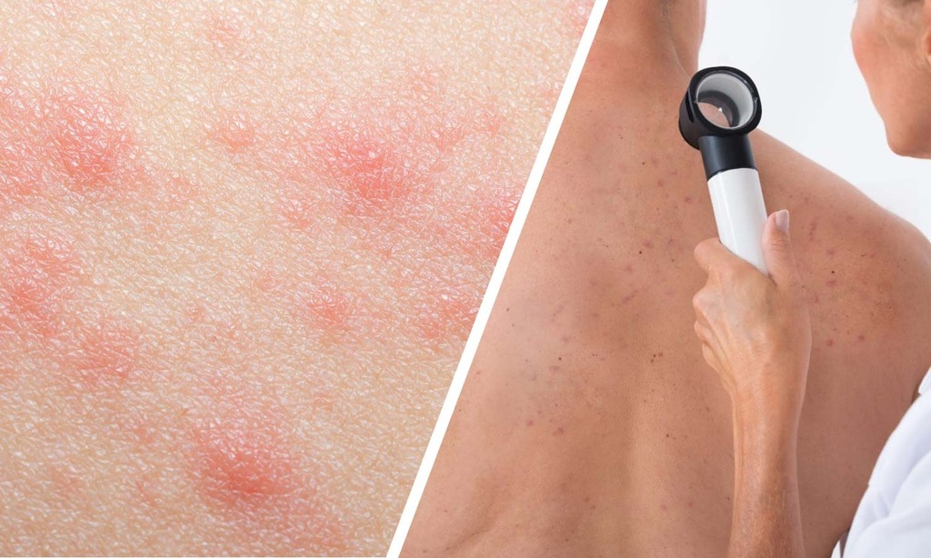 الأمراض الجلدية والتناسلية