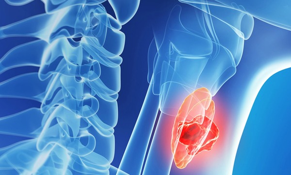 Онколо́гия 